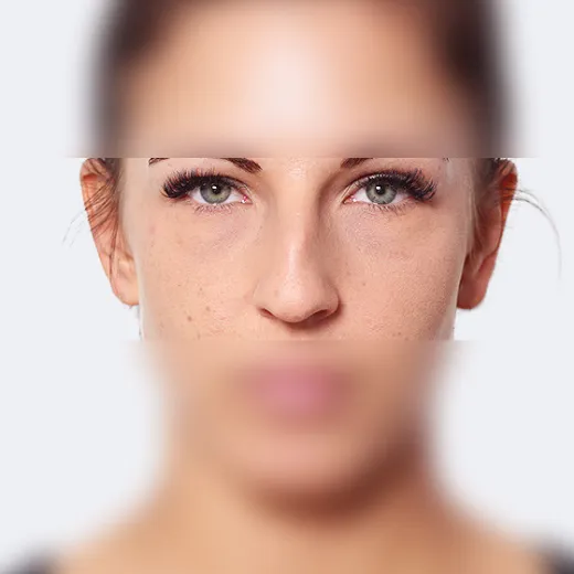 Image before