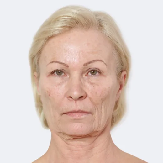 Image before