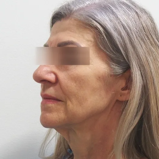 Image before