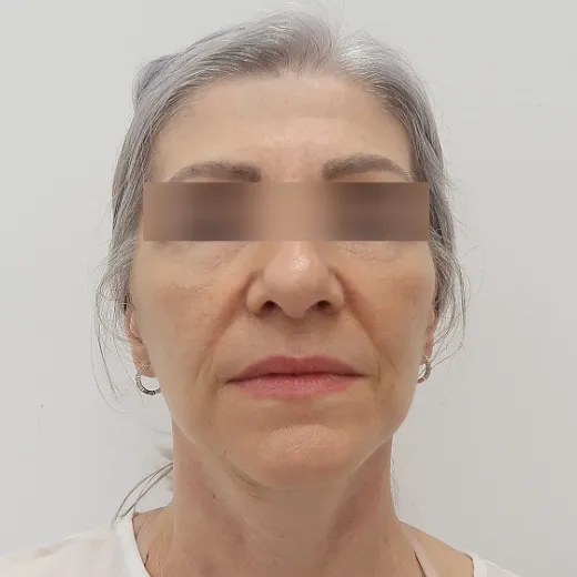 Image before