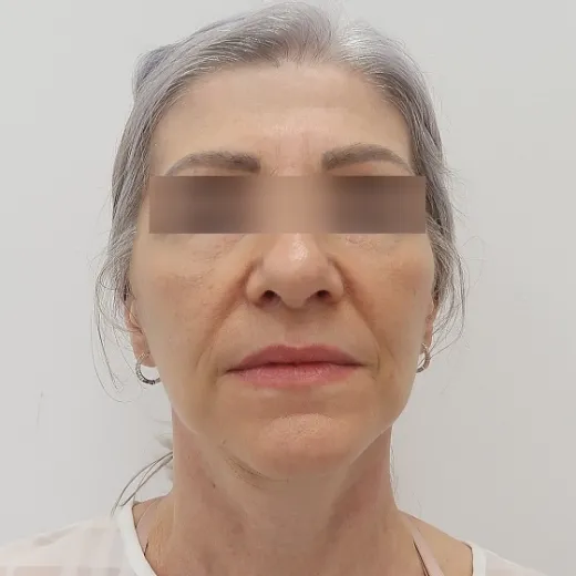 Image after