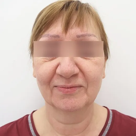 Image before