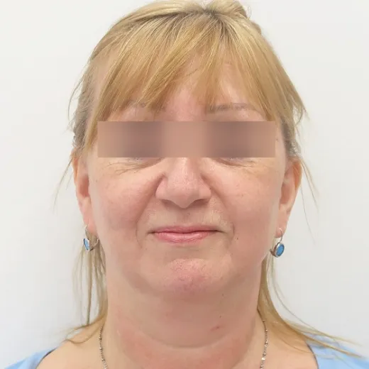 Image after