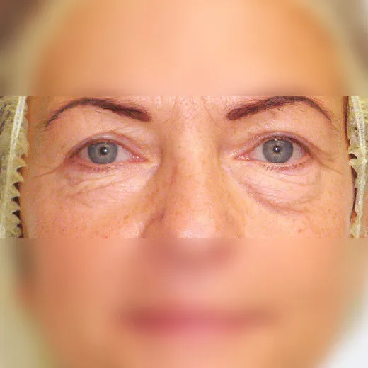 Image before