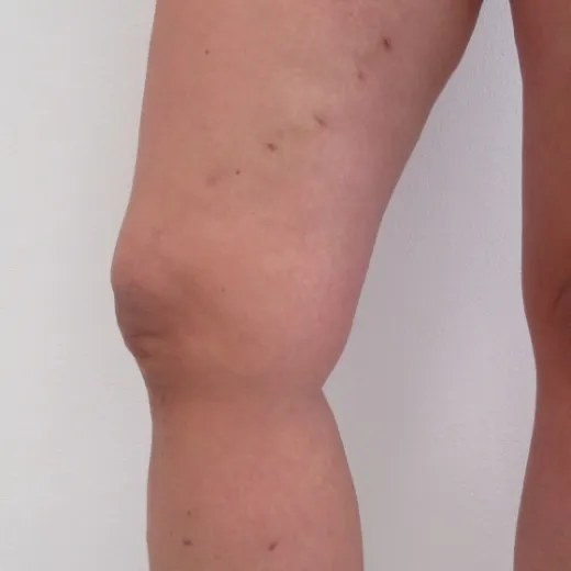 Image after