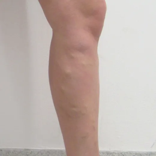 Image before
