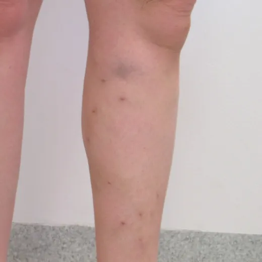 Image after