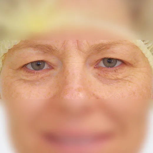 Image before