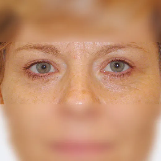Image after