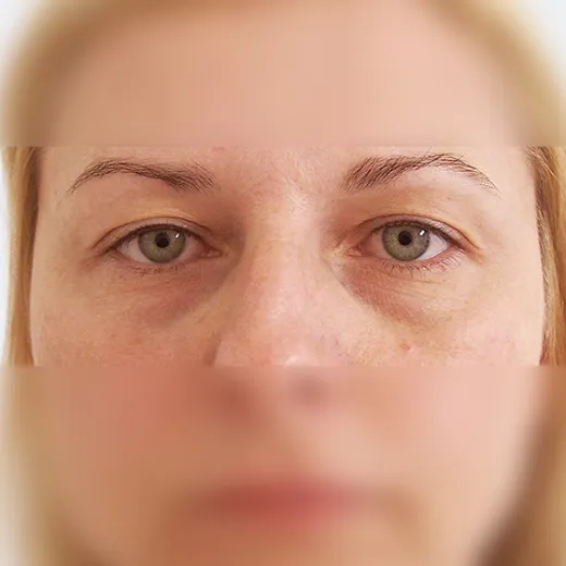 Image before