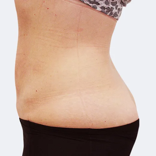 Image after