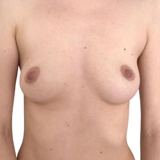 Image before