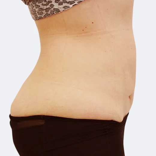 Image after
