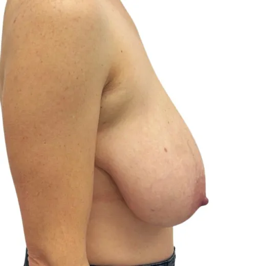 Image before