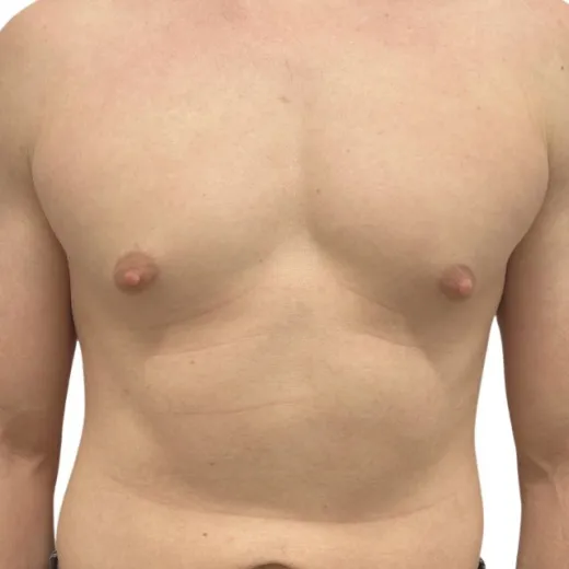 Image before