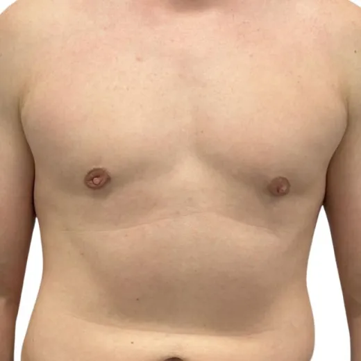 Image after