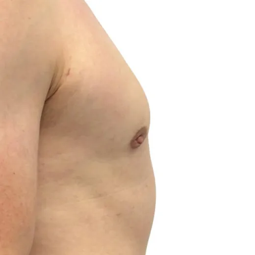 Image after