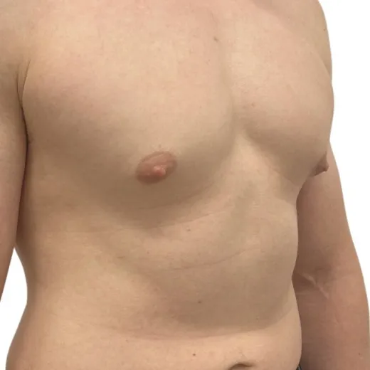 Image before