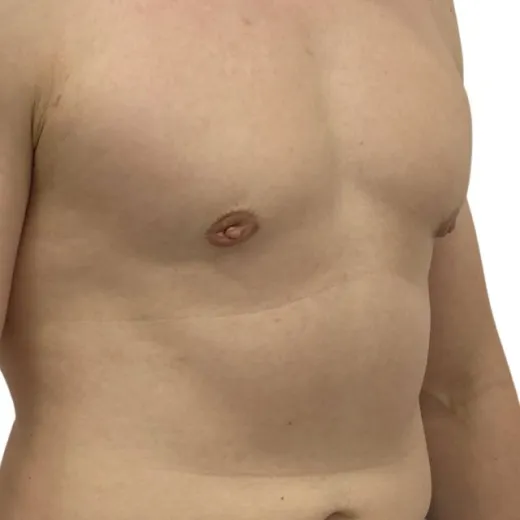 Image after