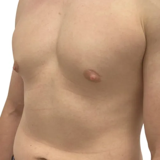 Image before