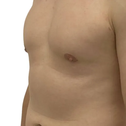 Image after