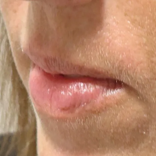 Image before