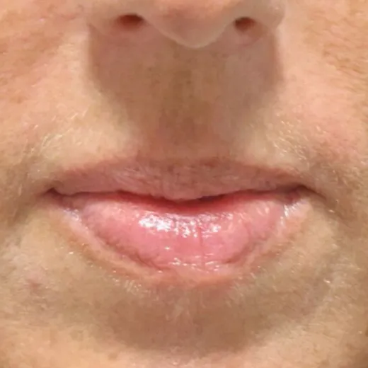 Image before