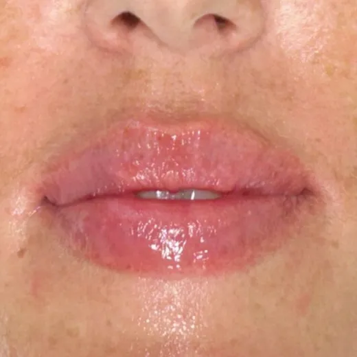 Image after