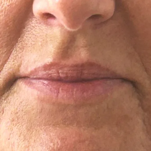 Image before