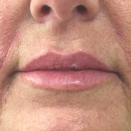 Image after