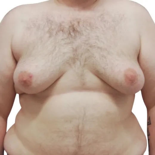 Image before
