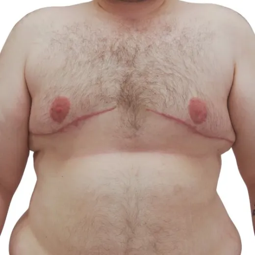 Image after