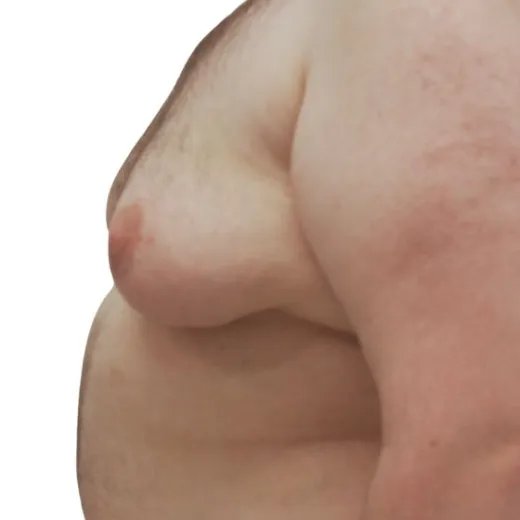 Image before
