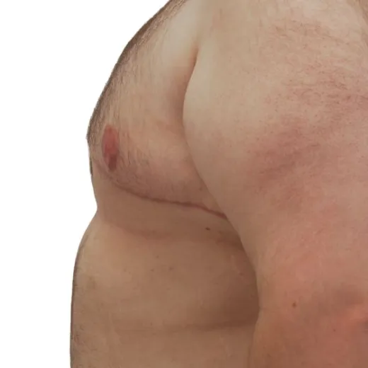 Image after