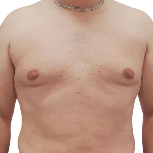 Image after