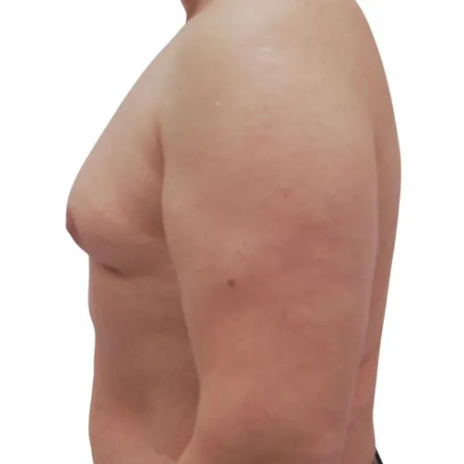 Image before