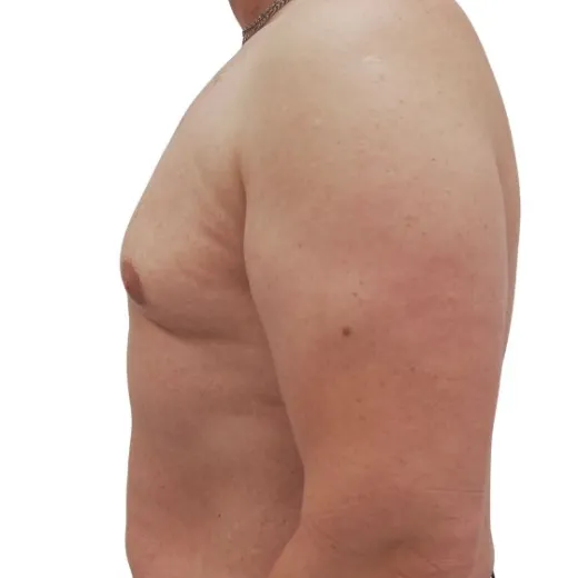 Image after