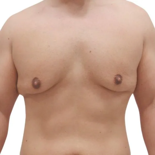 Image before