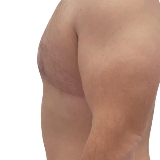 Image after