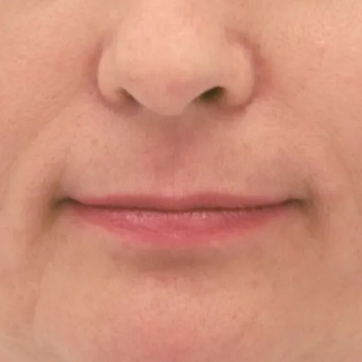 Image before