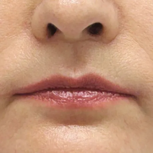 Image after