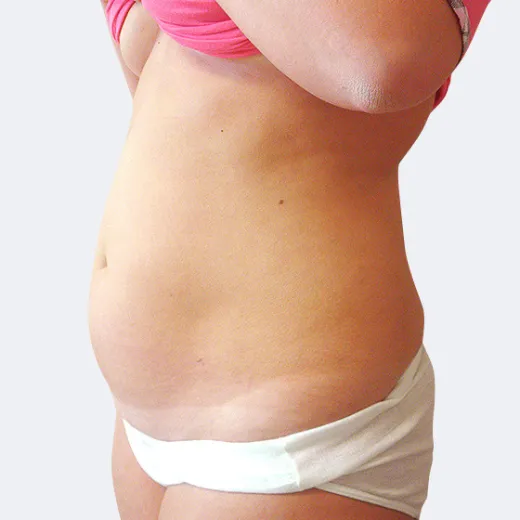 Image before