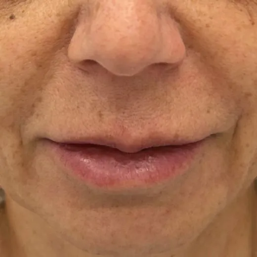 Image before