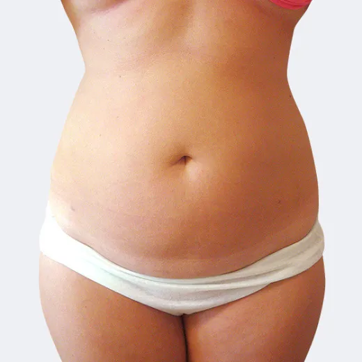 Image before
