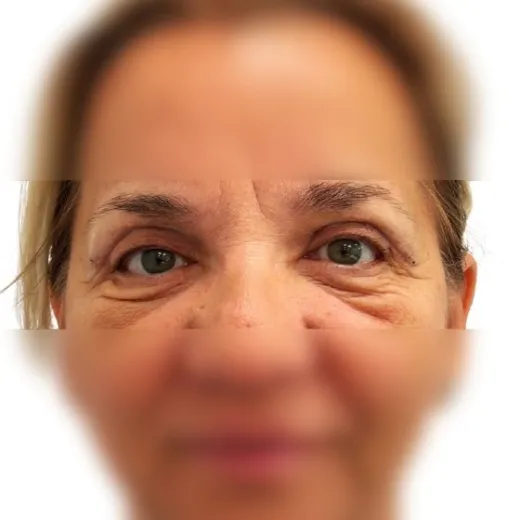 Image after