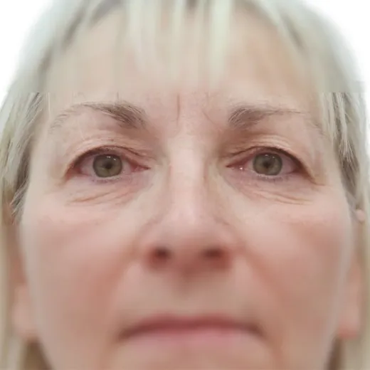 Image before