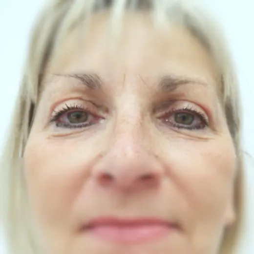 Image after