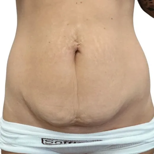 Image before