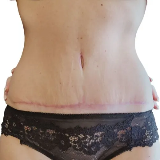 Image after