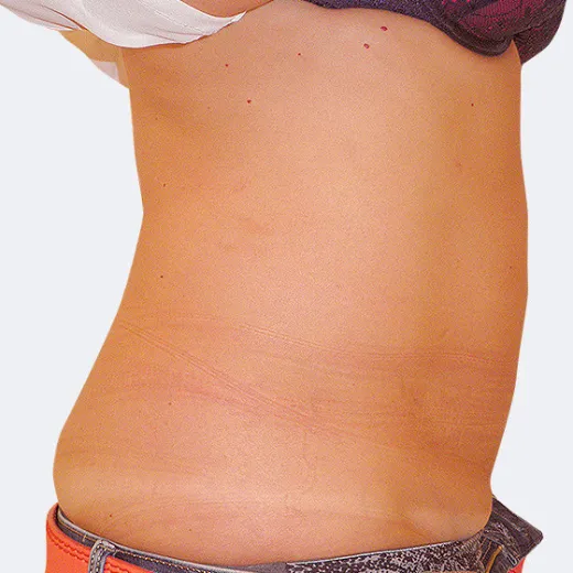 Image after
